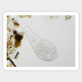 Bdelloid rotifer under the microscope Sticker